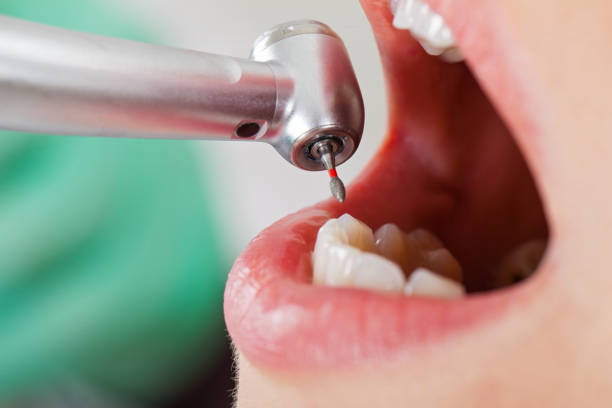 Best Dentist for Severe Toothache  in Port Hueneme, CA